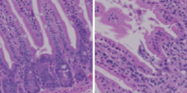 Ceramides and increased cancer risks