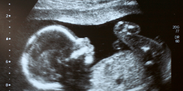 Could AI predict pregnancy risk?