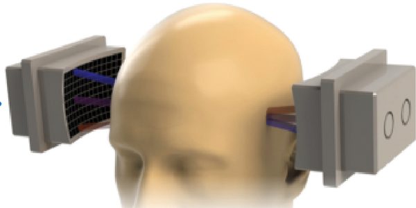 Treating chronic pain with ultrasound
