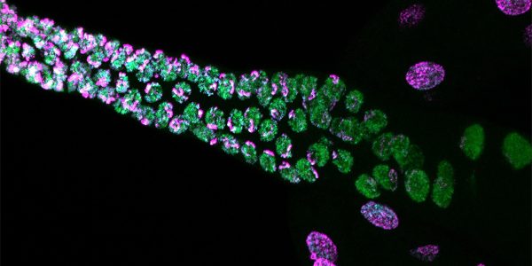 A tale of two worms: How my research is advancing the field of epigenetics