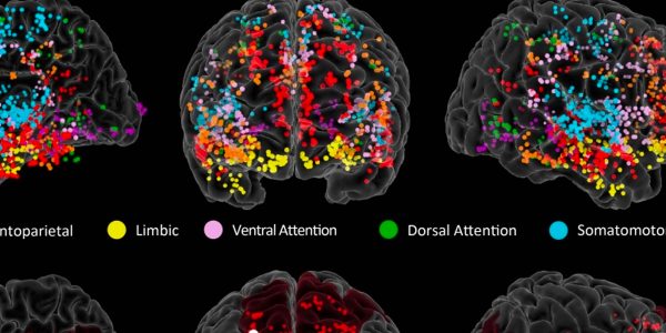 Study pinpoints origins of creativity in the brain