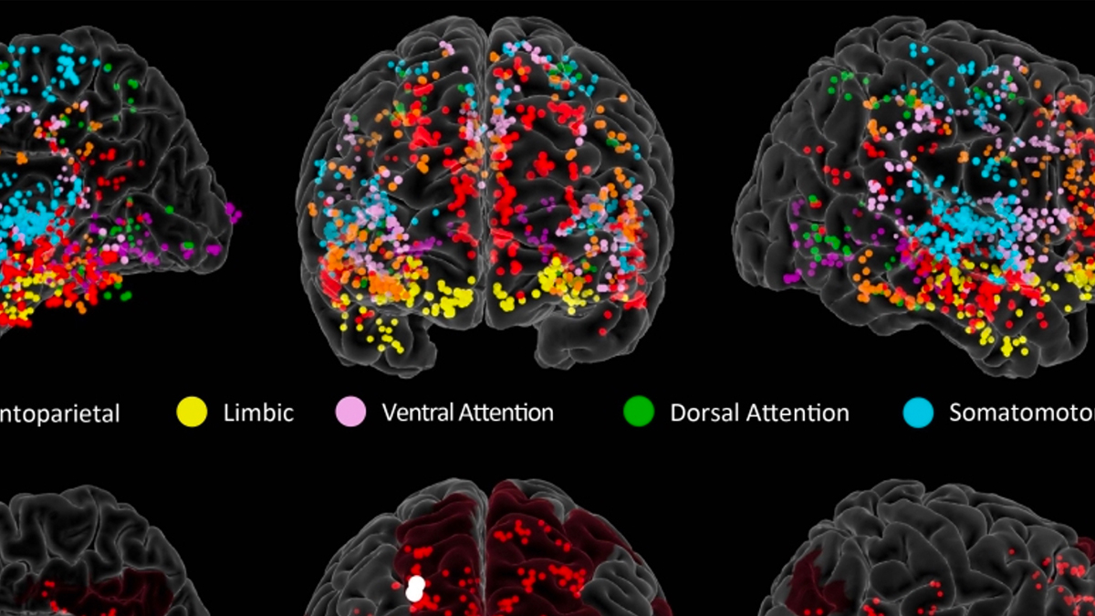 Study pinpoints origins of creativity in the brain – @theU