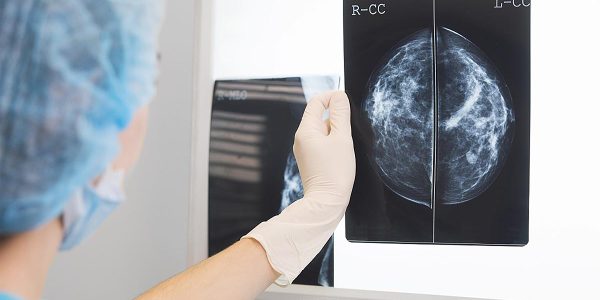 The connection between reproductive health and certain cancers