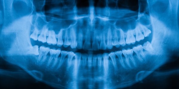 The history recorded in your teeth