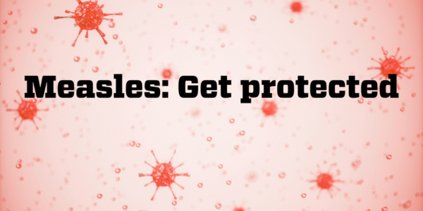 Don’t let measles crash campus