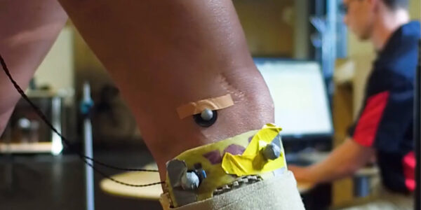 A potential way to relieve arthritic knees without drugs or surgery