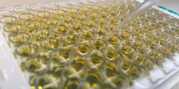 Research uncovers why IBD causes blood clots
