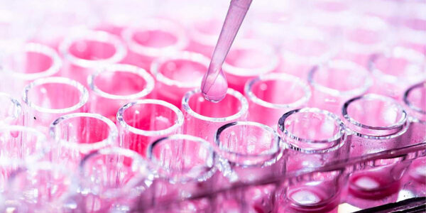 Study links obesity-driven fatty acids to dangerous form of breast cancer