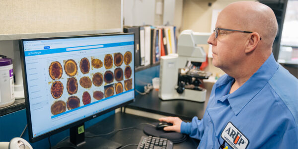 AI excels at detecting parasites in stool samples, study finds
