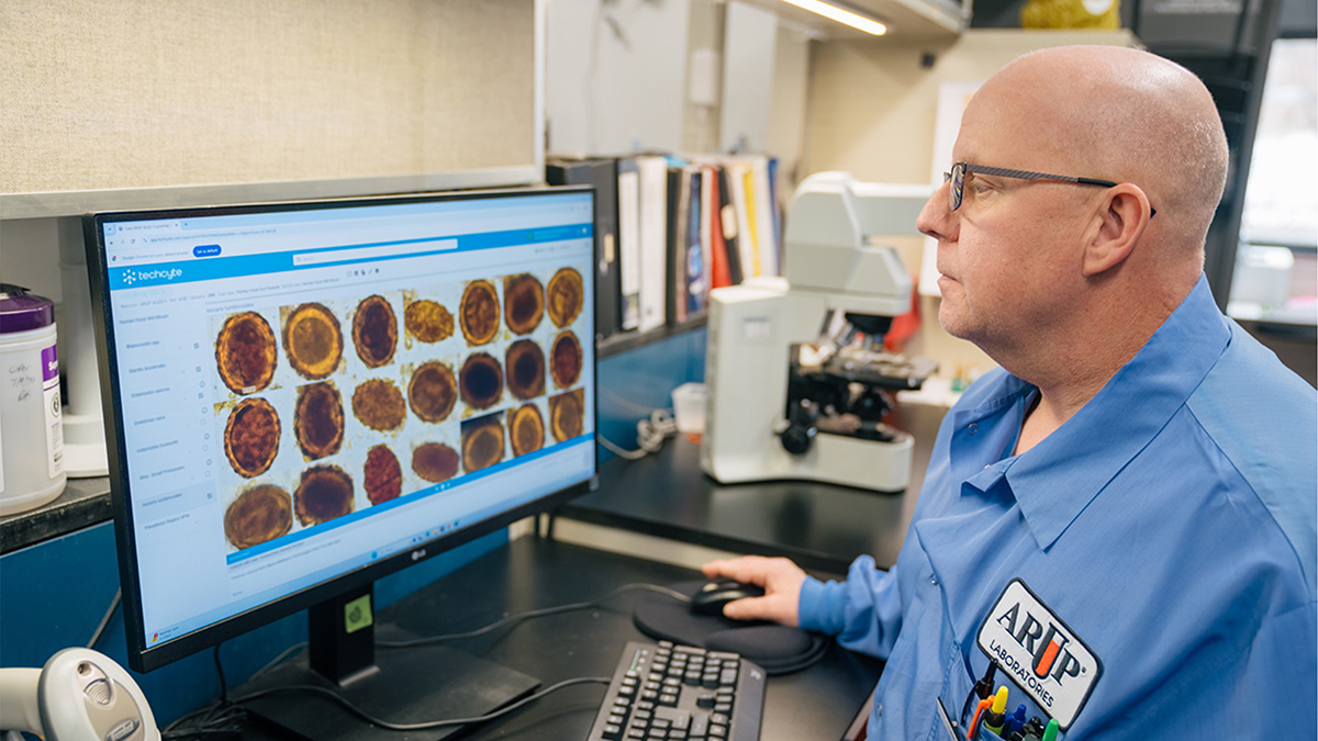 AI excels at detecting parasites in stool samples, study finds