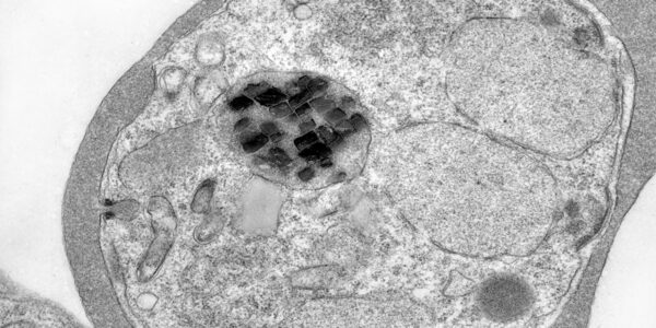 Malaria parasites are full of wildly spinning iron crystals. Scientists finally know why