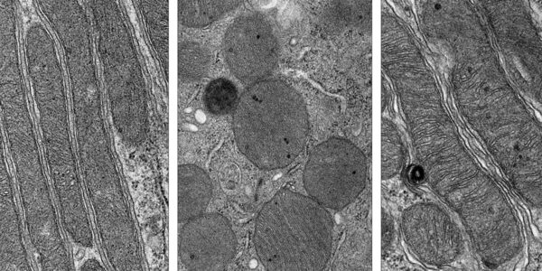 New drug protects mitochondria and prevents kidney injury in mice