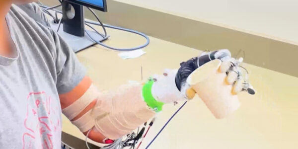 U engineers give a bionic hand a mind of its own