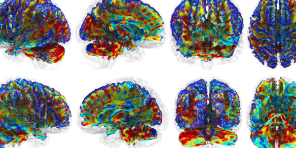 Near-infrared light therapy shows promise for protecting football players’ brains