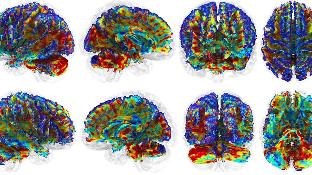 Near-infrared light therapy shows promise for protecting football players’ brains