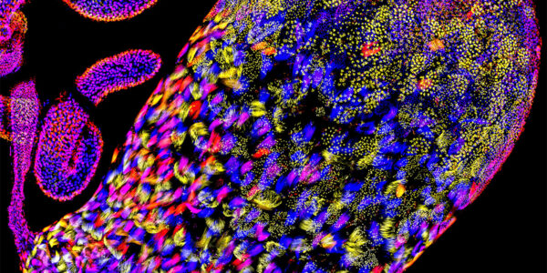Selfish sperm hijack genetic gatekeeper to kill healthy rivals